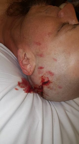 Thane Farace - injured - April 24 - 2016 - Rabid Assassin - #MO99099ILMFM